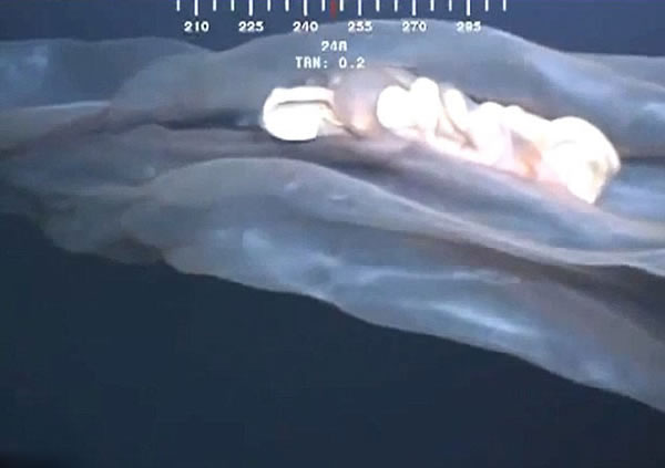 ī������5000Ӣ��������㵽�ġ����֡�֤ʵΪ̥��ˮĸ