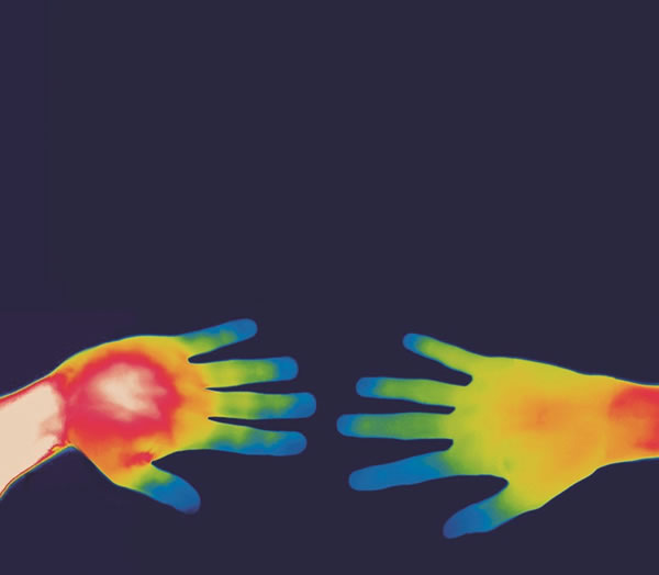 ������Ů���ֲ��¶ȵĲ��죬͸��������Ƭ��¶����