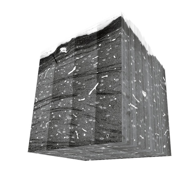 将1万张这种显微照片堆叠起来所产生的3D模型不会比一颗盐粒大(如图中镊子里所示)。如果要以如此精细的程度显示人脑影像,所需要的资料量会等于全世界图书馆里所有书面