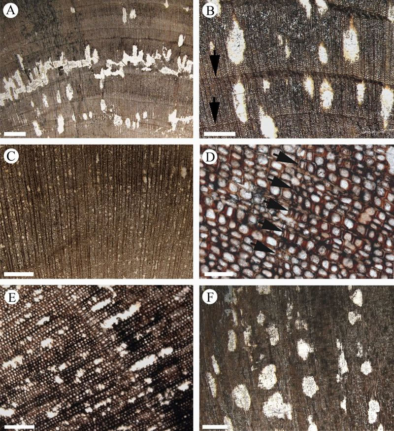 Septomedullopitys szei sp nov.ľʲ