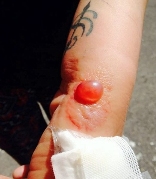 ³�ı�֩��ҧ�󣬳���һ���ʺ�󶾴���