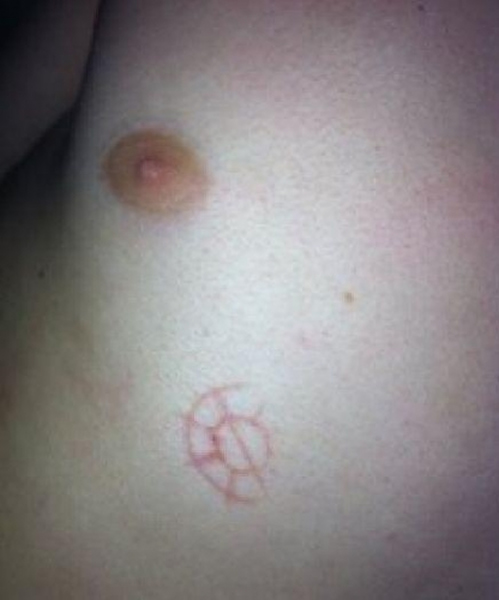 一觉醒来,身上突现圆和直线构成的神秘符号