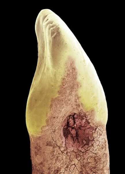 ϸ�����ʴ����