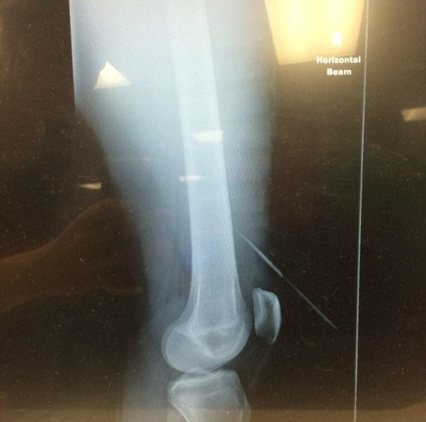 ��X��Ƭ�ɼ�����̽����ܹ�����ɭ�Ĺ�ͷλ�á�