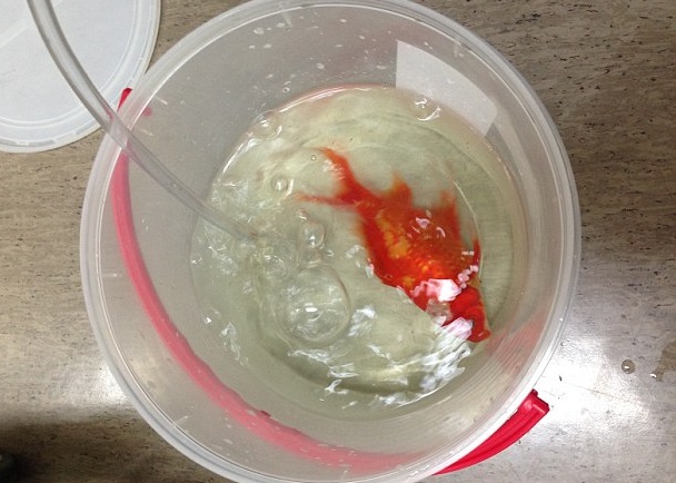 乔治正在康复中