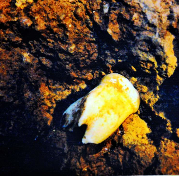 么会洞发现的巨猿牙齿化石