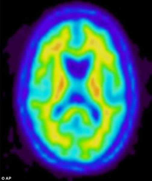 随着恒星塌缩过程的进行,其内部开始快速合成重元素,如氧,氖,镁和硅。这一过程会释放大量能量,它最终将逆转塌缩进程,并引发超新星爆发