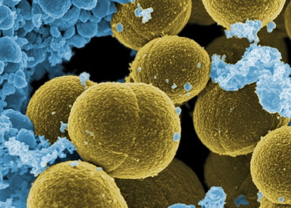 专家指新药可有效消灭抗药性金黄葡萄球菌(图)等病菌。