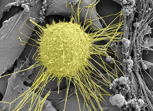 ��΢���µ�һ�����ٰ�ϸ��