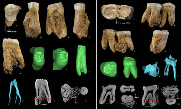 和县人牙齿釉质、齿质、髓腔形态特征(邢松供图)