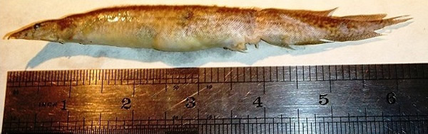 孟加拉少年捕鱼险遭6.5吋长鳗鱼鲠死