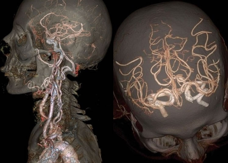该款革新扫描器,可制作出超高清影像。