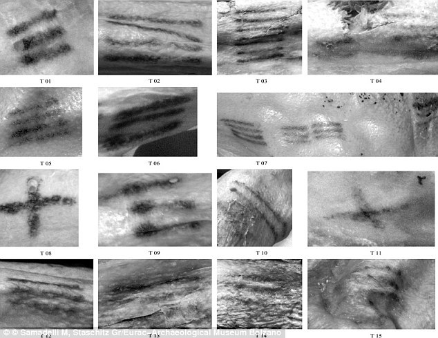 ���ˡ��´ġ����ϵ������ںܴ�̶��ϳ������𣬵��¿���ѧ�ҽ�����������Ʒ���ϵ��һ�𡣶���߸�ʬ�����������еķ�����ɨ����ʾ�������·�����֯�����˻����ɵ�����ʹ��