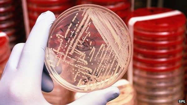 最新发现注射特定细菌能杀灭癌细胞