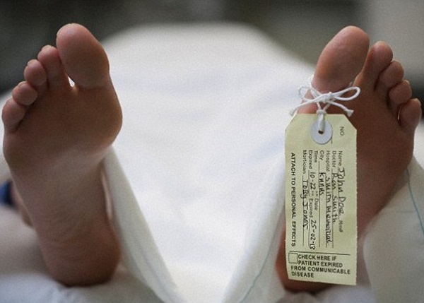 专家指尸皮或有助治疗伤口