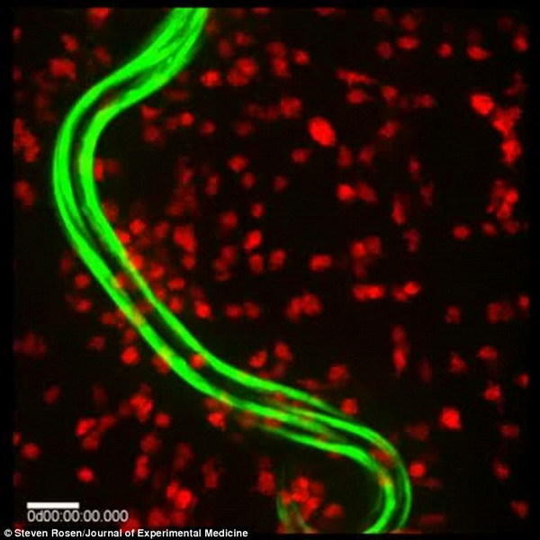 ͼϸǺɫ֣߳׳ɫ֣ƬǳʵʾڰѪϸι档ڴԼ54ʱ߳濪ʼһȺ