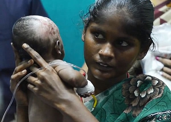 拉杰斯瓦丽(右)声称2名儿子先后出现自燃现象。