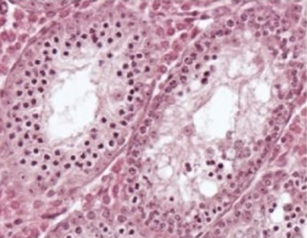 这种酶很可能是导致男性不育的变异来源