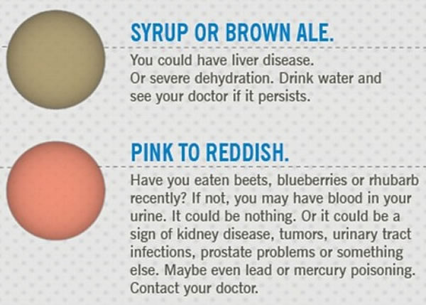 ��Һ����ɫ���ϣ���������ȱˮ����������ë���� �ۺ�ɫ���£���������ţ���ݮ�����¡�