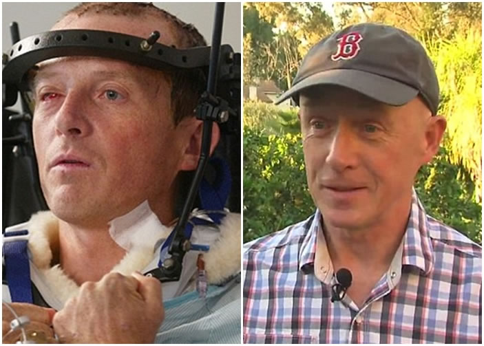 奥特遇袭后头部遭重创(左图),右眼更被挖掉。