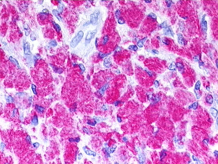 麻风分枝杆菌(Mycobacterium leprae)长久以来一直被认为是麻风病唯一的病原体