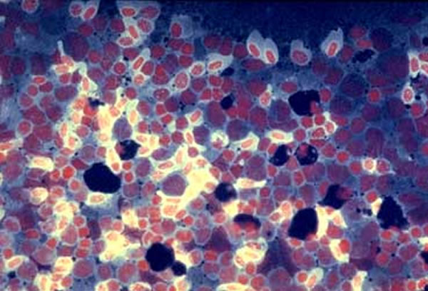 Ų��ָISA������ͼ���������޺�