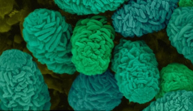 室内霉菌或会导致失忆和忧虑等征状