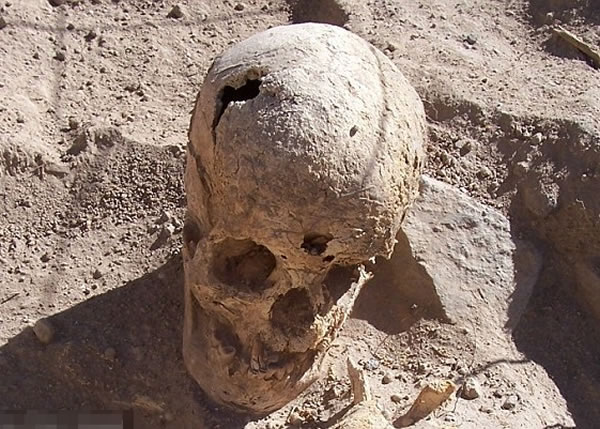部分遗骸的头骨有被击凹痕迹