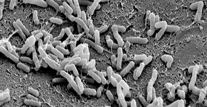 在全世界栽培的甘薯中发现了来自天然存在的细菌的基因