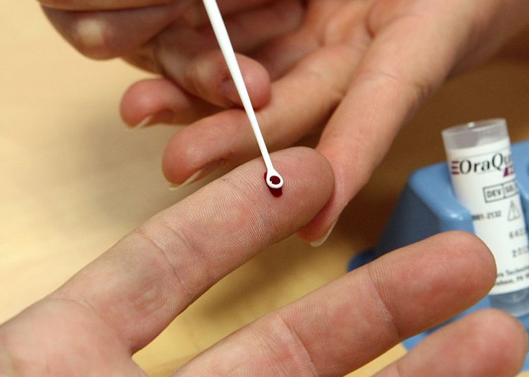 美国医学新检验法VirScan:一滴血验出过去现在病毒