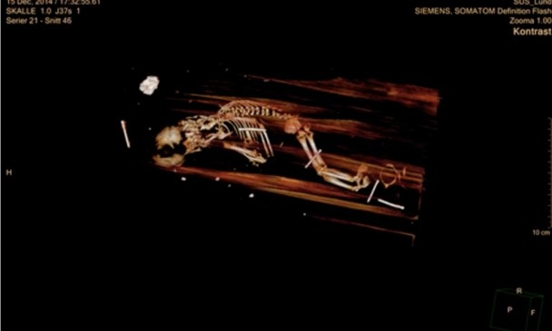 Ӥʬ���о�ԱΪ��ľ���е��Զϲ�ɨ��ʱ����