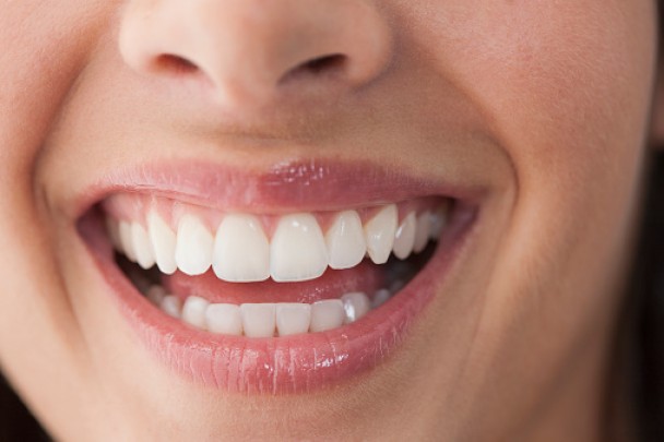 牙齿关乎一个人的笑容亲和力