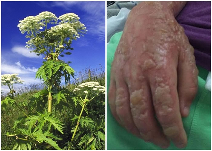 ����ͯ��������������أ���ͼΪ�ж�ֲ��������ݡ�