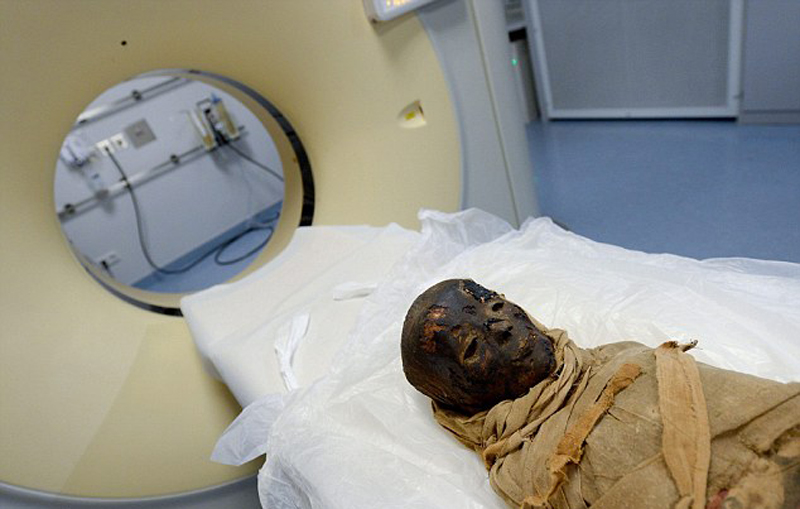 ߹Űͯľڵ¹ϣ˹ķʥɵҽԺCTɨ