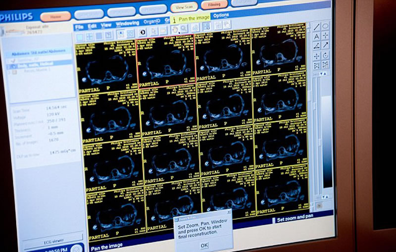 2014ʱӢչCTɨ輼ο͹ۿľײڲ龰ʬϵİϡƬʾľƬ