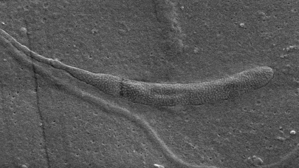 南极出土最古老动物精子化石 来自距今五千万年前的结茧蠕虫