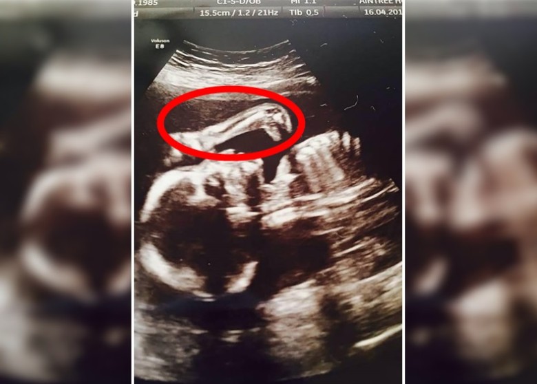 ��ҿ������������𣿾��ڱ�����ͷ�ϣ���Ȧʾ����