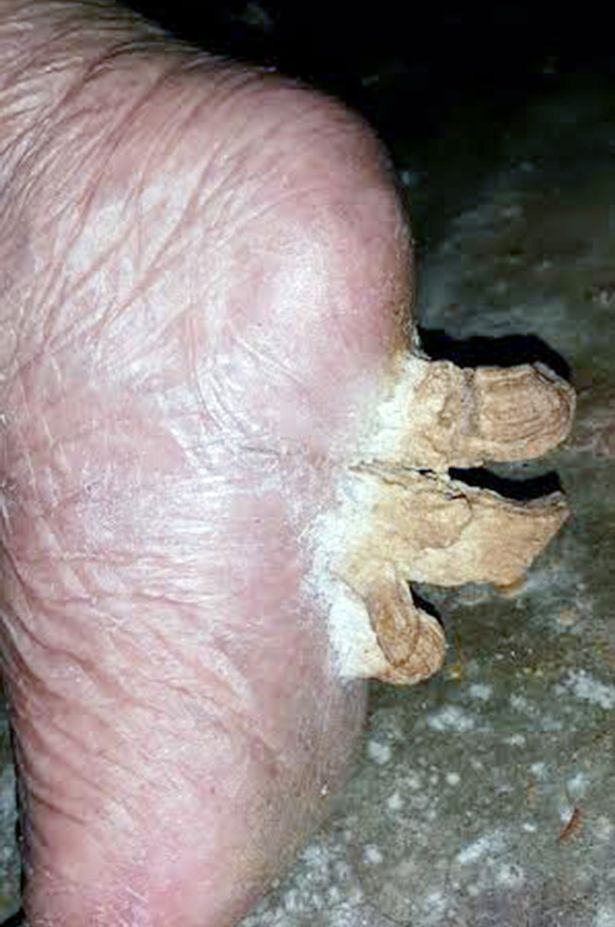 这3块巨型“脚甲”,可能是“皮角”。