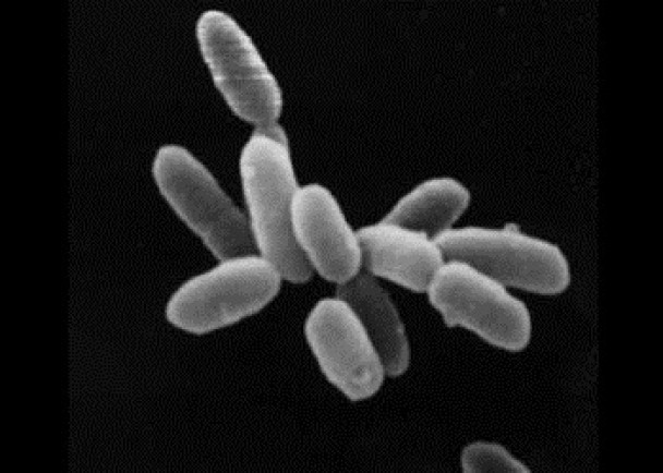 日本研究首证实古细菌可感染人类