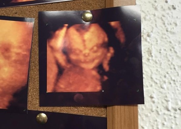 ���ſֲ�4D�������������Ϸ贫