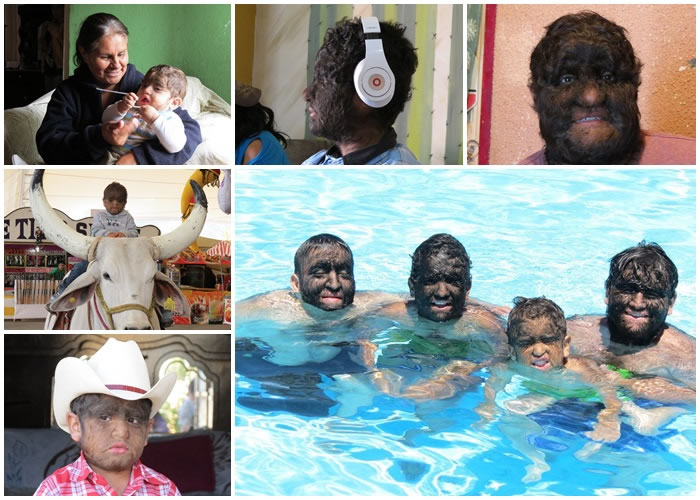 ����Τ˹������ͼ��������Ա�����ж�ë֢��