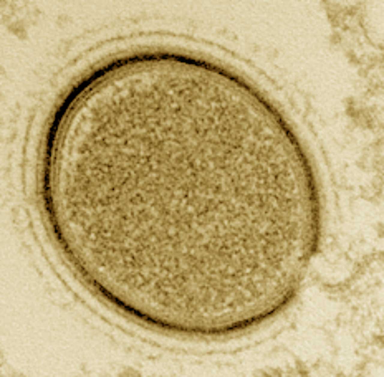 科学家将复活深埋在俄罗斯西伯利亚冰天雪地里的3万年前巨型病毒