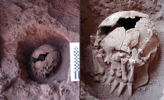 巴西出土的9000年历史的被斩头骨及断手
