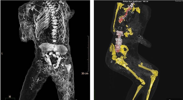 左图是一名遇难者的脊骨、肋骨以及盆骨照片,右图则标注出另一名遇难者的盆骨、股骨以及膝盖骨。这些骨骼以不同的颜色展示,容易辨认。
