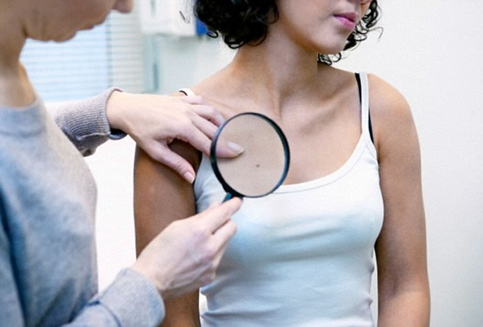 照日光灯可能增加患黑色素瘤或其他皮肤癌的机会