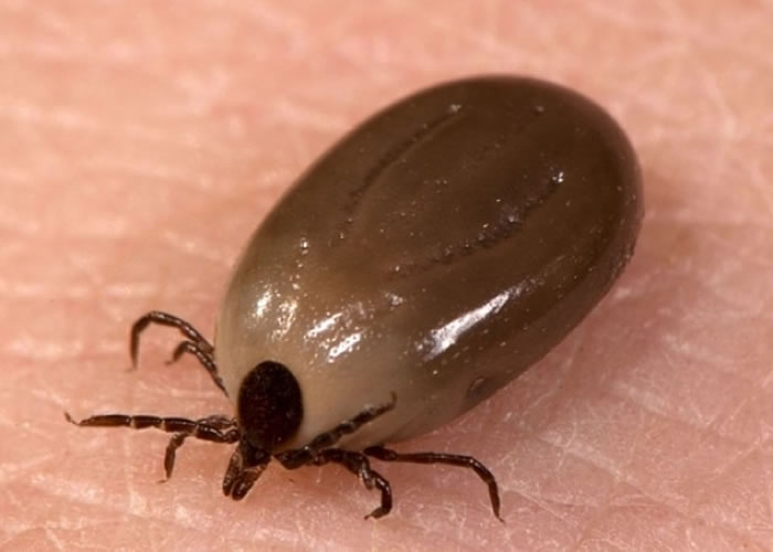 英科学家发现新疾病“Borrelia Miyamotoi” 由蜱虫传播致头痛乏力