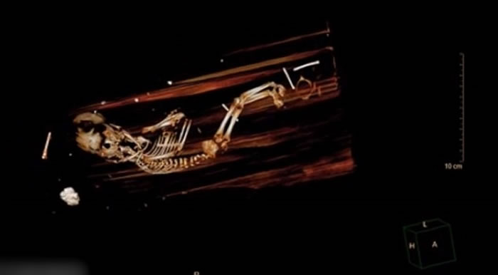 ��ѧ��ɨ���ľ���������̽�������һ��̥ʬ��