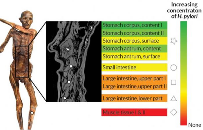 来自5300年前木乃伊“冰人”的肠道微生物给远古人文地理提供线索