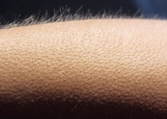 人类祖先透过竖“鸡皮”吓退敌人