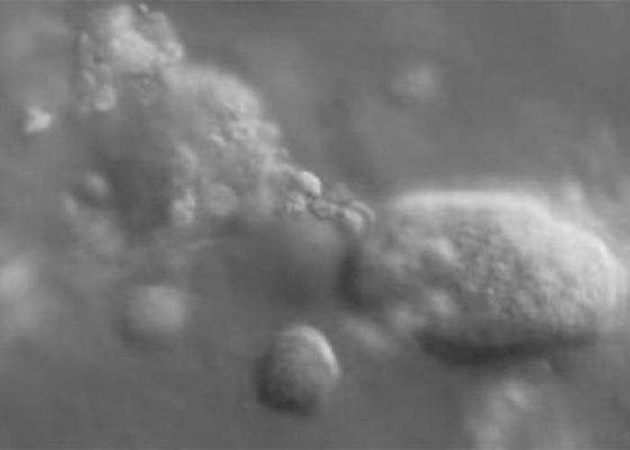 美国科学家利用3D摄影技术首次成功追踪癌细胞在人体内活动